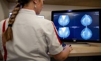 ‘Paniek om stijging kanker onder vijftigers niet terecht’