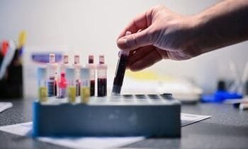 aantal hiv-diagnoses in Nederland daalt niet langer